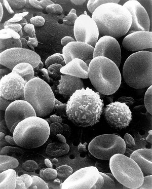 scanning electron microscope image of normal circulating human blood